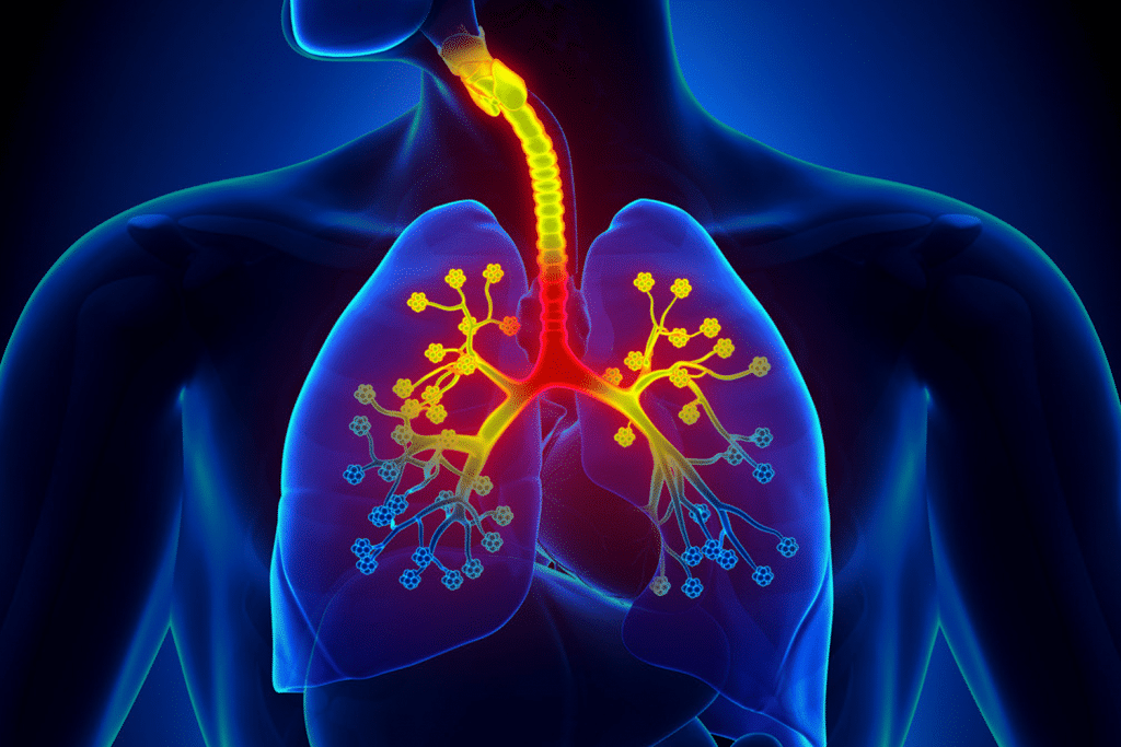 Lignosus United States - Blog Article - Everything You Need to Know About Curbing the Symptoms of Bronchitis Image 1