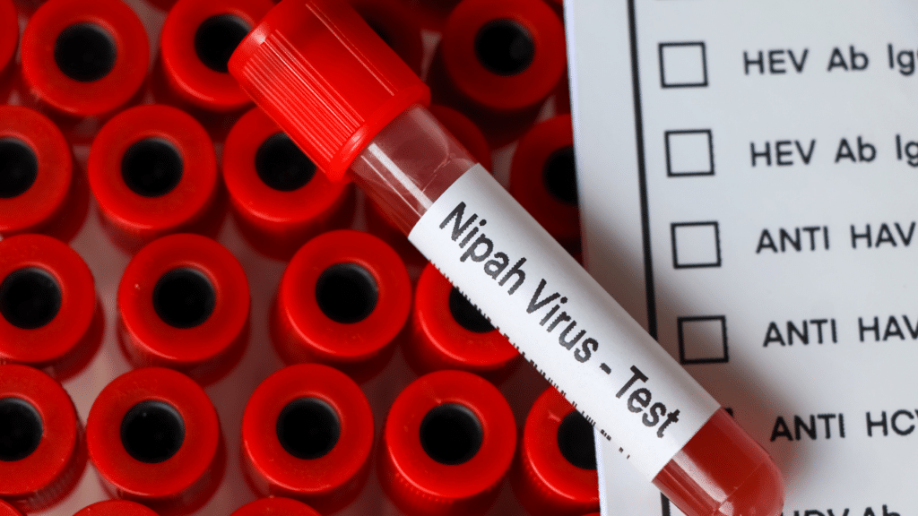 Nipah Virus: The Threat and the Shield